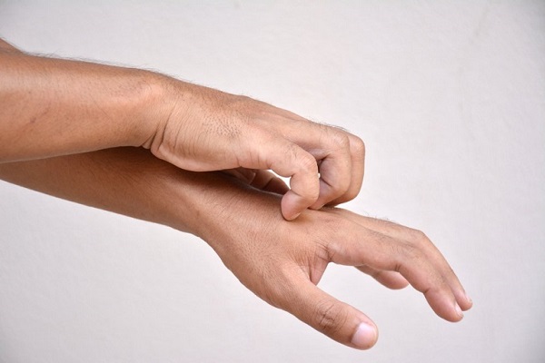 Bị ngứa tay chân không rõ nguyên nhân Bị ngứa tay chân không rõ nguyên nhân